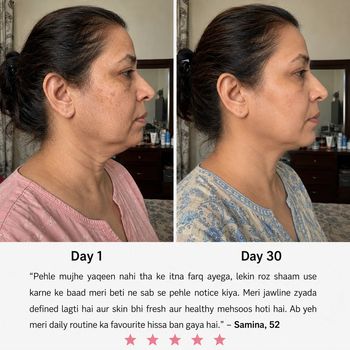 AURÉL 3-in-1 LED Facial Sculptor - EMS and heat mode facial device